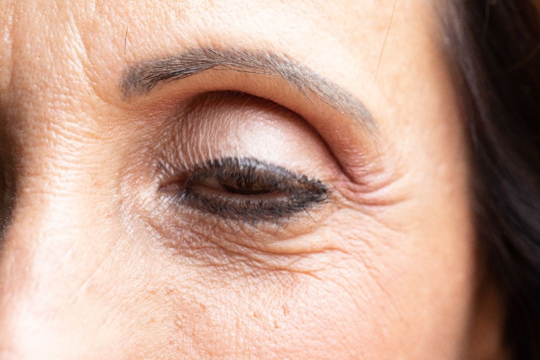 Fix drooping eyelids